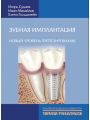 Зубная имплантация. Новый уровень протезирования